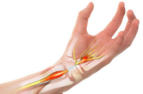 cách chữa đau nhức khớp cổ tay